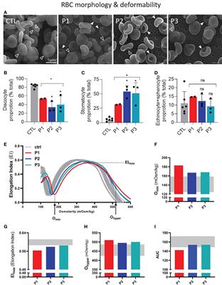 Red blood cells from patients with sitosterolemia exhibit impaired membrane lipid composition and distribution and decreased deformability